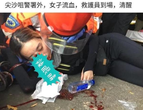 香港示威女子眼部受伤 医护人员:非警队射击范围 除非子弹会拐弯