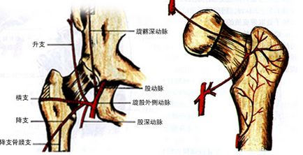 股骨头坏死和遗传有没有关系