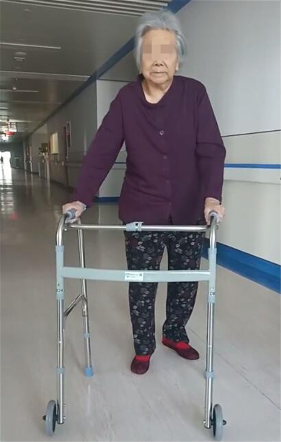 威海市中心医院成功为99岁老人完成股骨头置换手术
