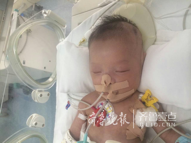 每天医疗费花费近万元!新泰三胞胎最小者病危