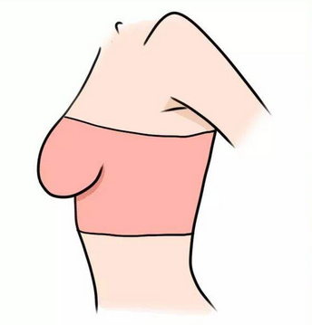 关于胸部下垂,你所知道的这些都是错的