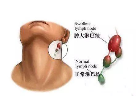 这种癌来得静悄悄~出现上腹部疼痛先别急着用药!