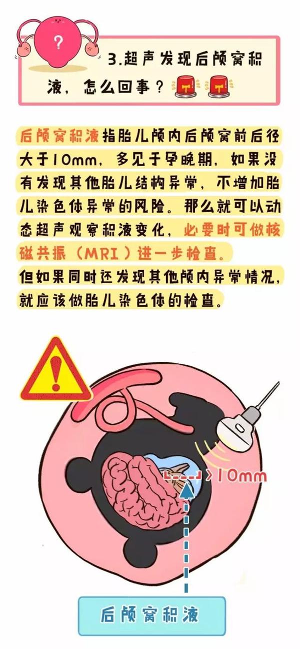 1度唇裂b超图图片