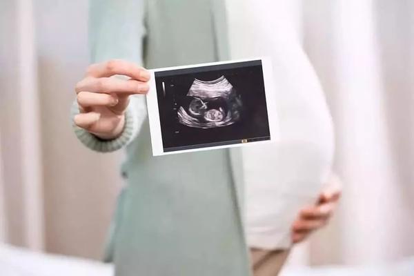 胎儿背对妈妈B超图图片