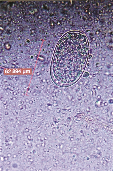 显微镜下寄生在这批走私穿山甲身上的寄生虫
