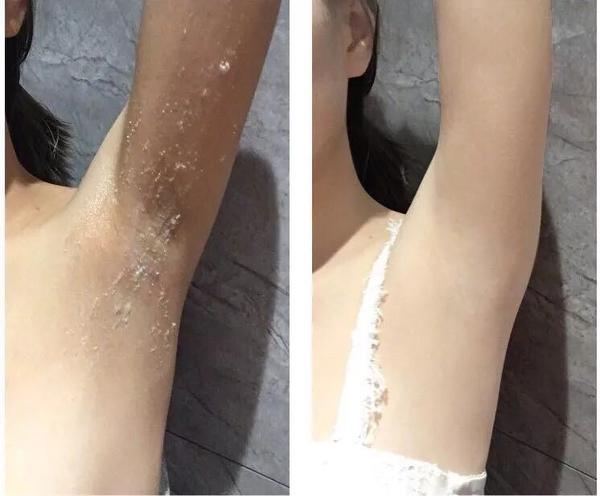 搓泥界的"爱马仕",30秒吸出陈年角质,污垢,7天效果堪比换皮!