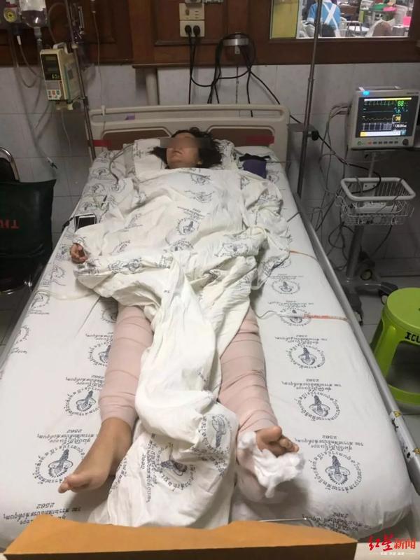 膝盖骨,大腿骨,胯骨,肋骨,手臂挠骨,肩胛骨皆有不同程度骨折和错位