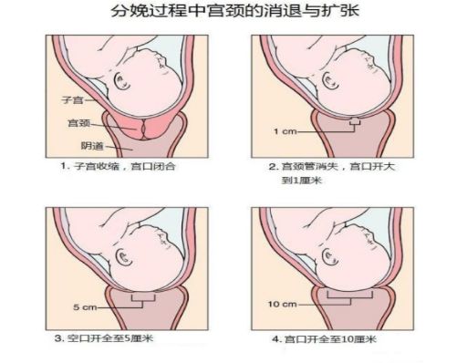 【首届微信医学科普大赛获奖文章展播】骨盆修复不等于盆底康复