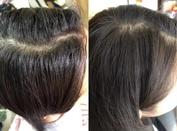 强劲发根→让每一根头发都鲜活有力量  咖啡因,维生素b群:控油去脏