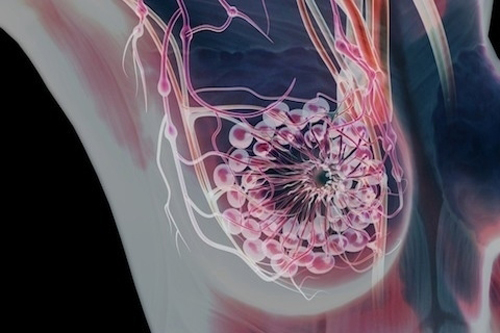 乳房缩小术优势与风险选择安全方式能避免吗