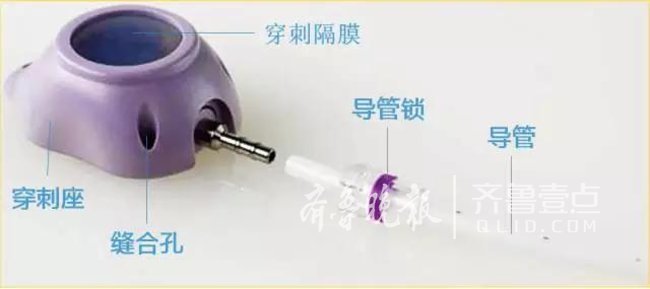 照市中医医院外三科成功完成院内首例输液港植