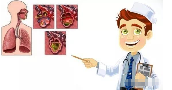 咳嗽,咳痰,呼吸困难逐步加重,紫绀逐渐加深;有桶状胸,胸部前后径增大