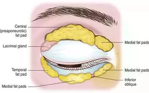 導致眼睛腫腫的