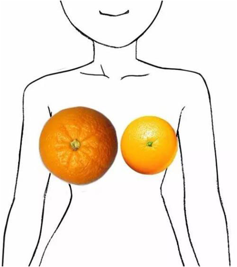 女性乳房阴历图片