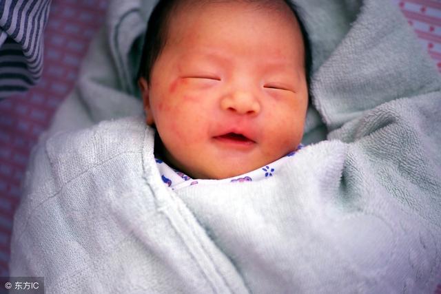 湿疹会遗传吗?如何才能避免湿疹遗传给宝宝?