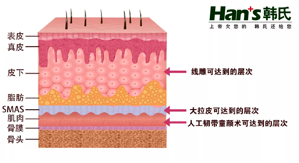 它可以穿过smas筋膜层,深度提拉肌肉