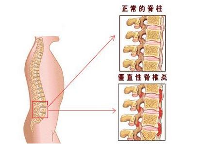 我们来看看济南股骨头