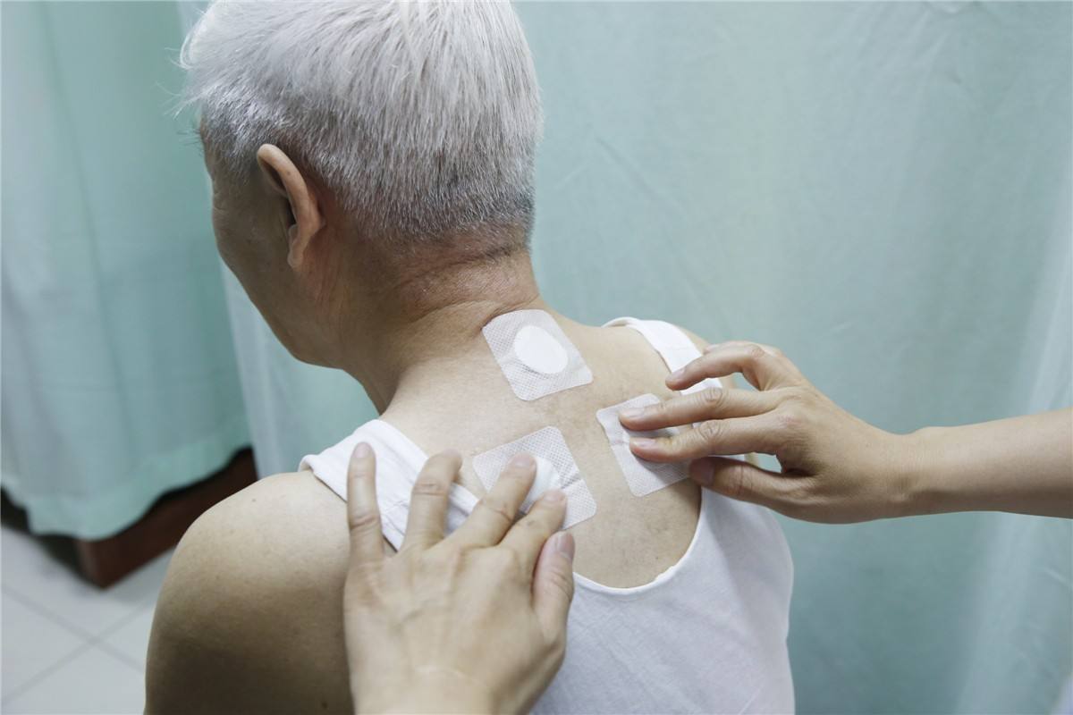 记住贴三伏贴出现这些反应一定要及时揭下